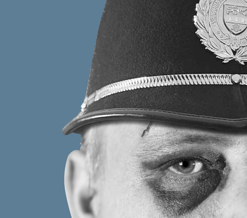 Police officer with a black eye